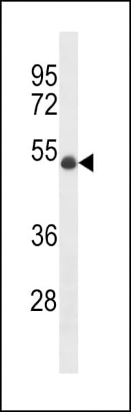 Polyclonal Rabbit anti-Human UBR7 / C14orf130 Antibody (aa100-128, WB)