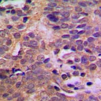 Polyclonal Rabbit anti-Human MDM2 Antibody (phospho-Ser166, IHC, IF, WB)