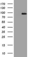 F13A1 / Factor XIIIa Antibody (clone OTI3F6)