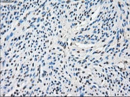 Monoclonal Mouse anti-Human CYPOR / POR Antibody (clone OTI3F10, IHC, IF, WB)