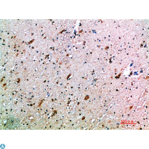 Polyclonal Rabbit anti-Human KLRK1 / CD314 / NKG2D Antibody (IHC)