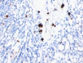 MYADM / Myeloid Marker BM-1 Antibody (clone MYUP1)