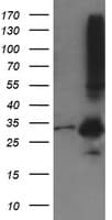 MMACHC Antibody (clone OTI1A4)