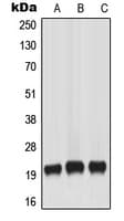 Polyclonal Rabbit anti-Human MLANA / Melan-A Antibody (Internal, IHC, WB)