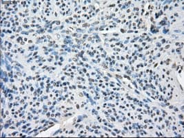 Monoclonal Mouse anti-Human BUB1B / BubR1 Antibody (clone OTI6E5, IHC, IF, WB)