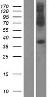 SLC39A1 Protein (Over-Expression Lysate Myc-DDK (Flag))