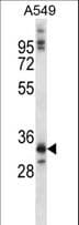 Polyclonal Rabbit anti-Human NKX6-1 Antibody (aa284-312, WB)