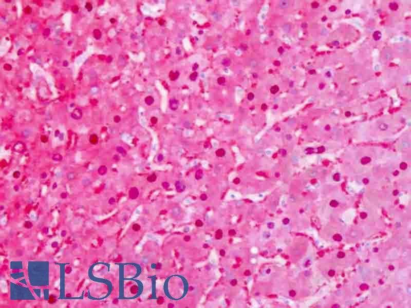 IHC-plus™ FAH Antibody