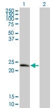 D52 / TPD52 Antibody (clone 1B6)