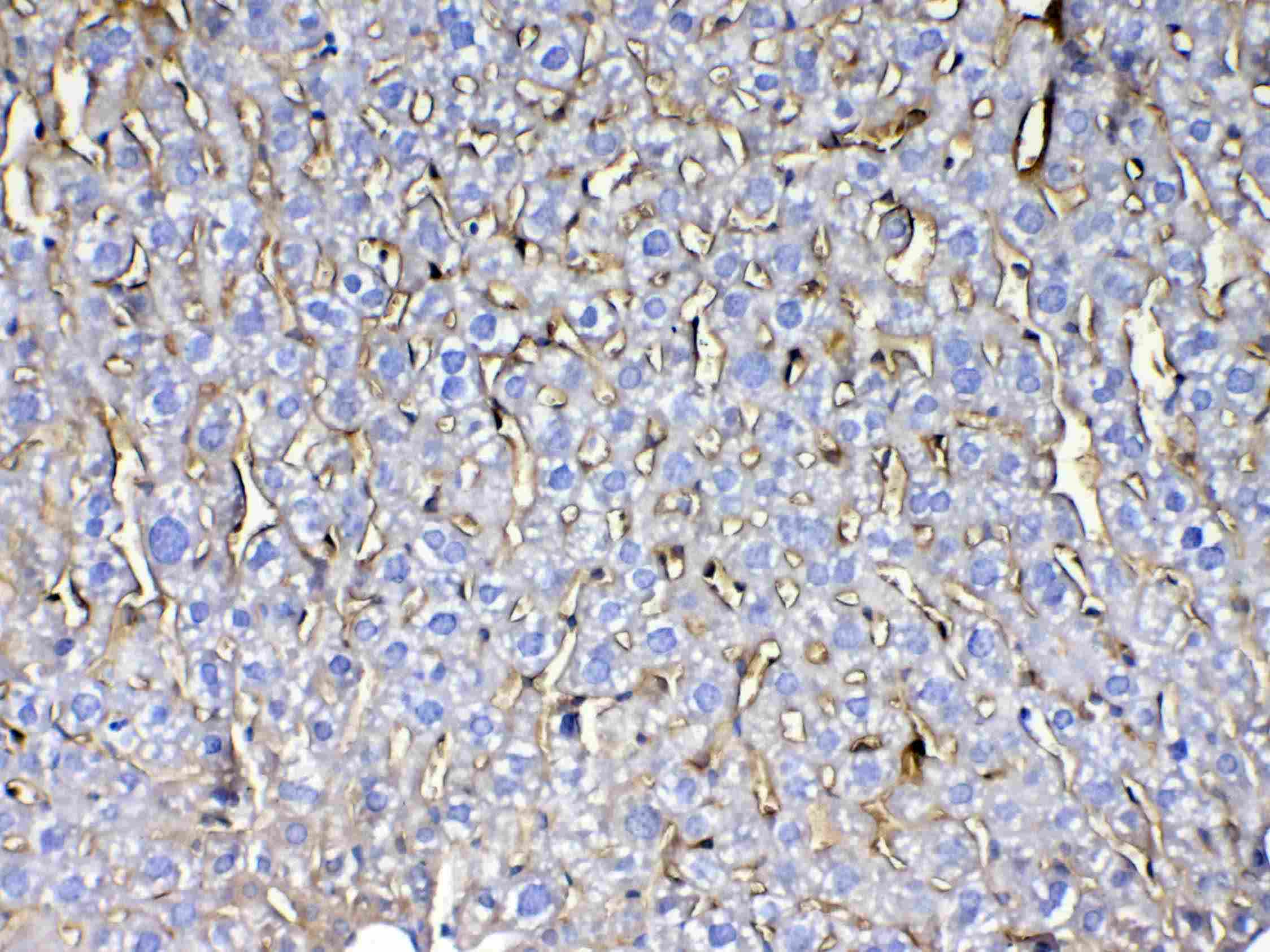 CD105 Antibody
