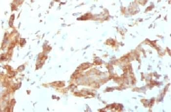 HSP90B1 / GP96 / GRP94 Antibody (clone SRPR90b)
