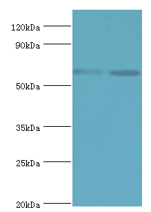 Polyclonal Rabbit anti-Human ASMTL Antibody (aa1-290, IHC, WB)