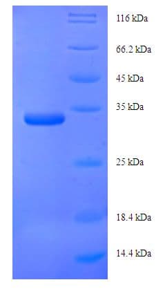 Saccharomyces cerevisiae RPN13 Protein (Recombinant His-SUMO)