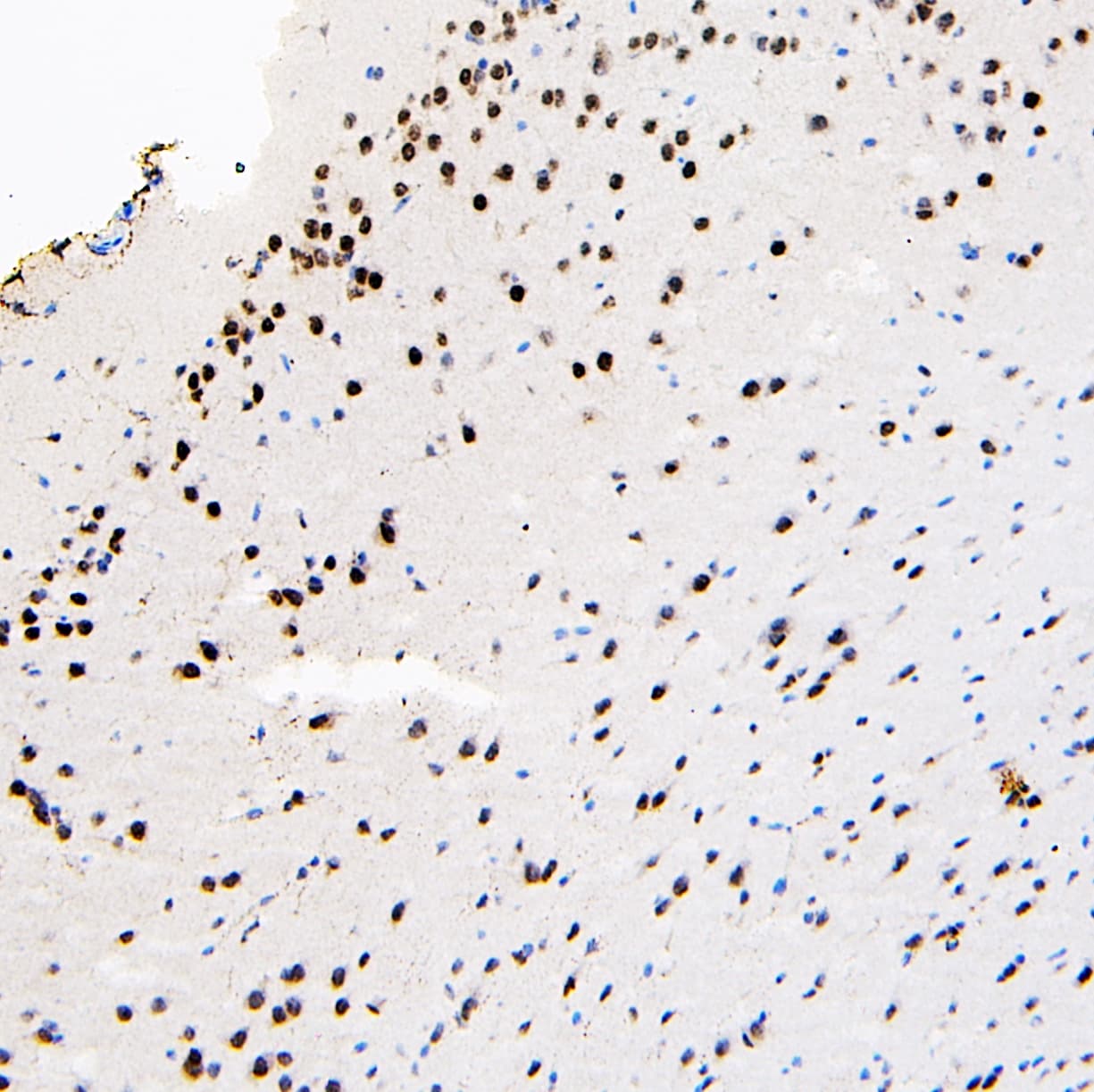 Polyclonal Rabbit anti-Human HNRNPL / hnRNP L Antibody (WB)