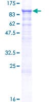 Human ADAM15 Protein (Recombinant GST)