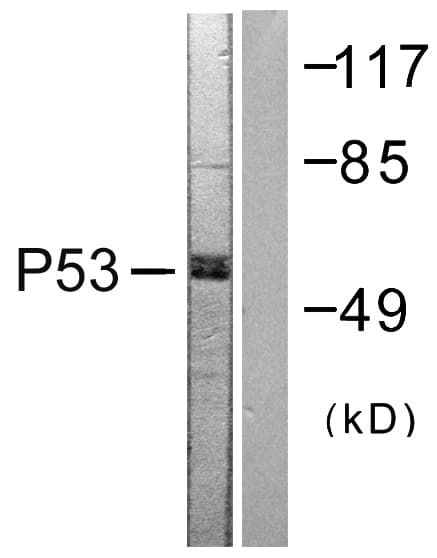 IHC-plus™ TP53 / p53 Antibody (aa344-393)