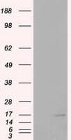 CDKN2B / p15 INK4b Antibody (clone OTI3E4)