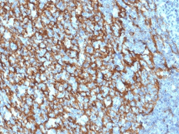CR2 / CD21 Antibody (clone CR2/1952)