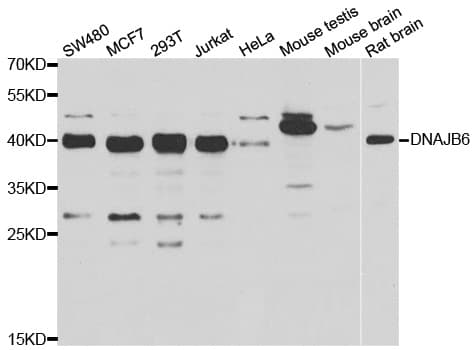 Polyclonal Rabbit anti-Human DNAJB6 Antibody (IHC, IF, WB)