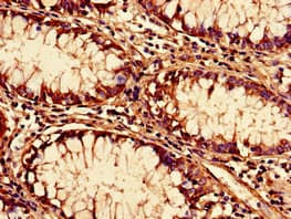 SF3B6 / SF3B14 Antibody