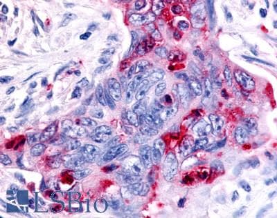 PathPlus™ MST1R / RON Antibody (C-Terminus)