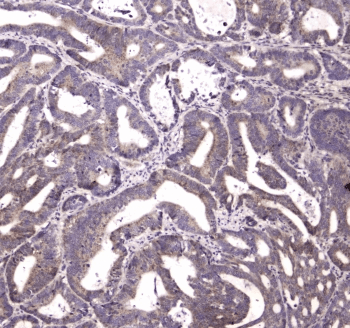 HTRA1 Antibody
