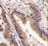Polyclonal Rabbit anti-Human MAPK4 / ERK4 Antibody (aa527-557, IHC, WB)