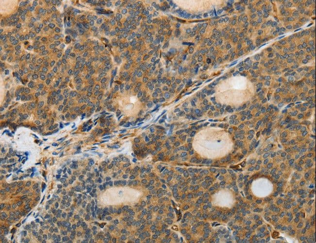 MSN / Moesin Antibody