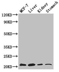Gpnat1 / GNPNAT1 Antibody