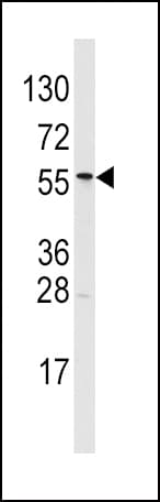 IHC-plus™ Polyclonal Rabbit anti-Human ALDH6A1 Antibody (aa30-59, IHC, WB)