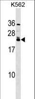 DHAND / HAND2 Antibody (aa81-110)