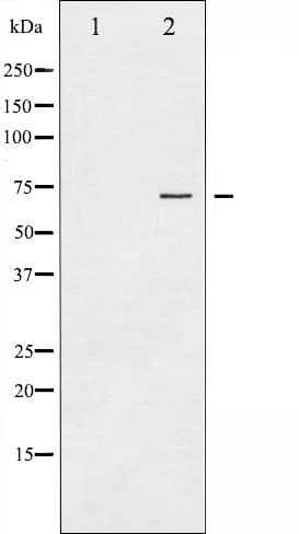Polyclonal Rabbit anti-Human PTPN11 / SHP-2 / NS1 Antibody (phospho-Tyr542, IHC, IF, WB)