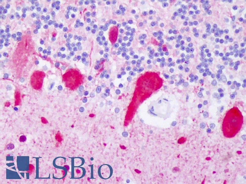 PathPlus™ TUBB3 / Tubulin Beta 3 Antibody (aa436-450)