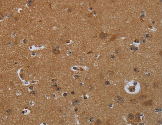 Polyclonal Rabbit anti-Human ENTPD7 Antibody (IHC)
