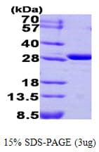 Human CA3 / Carbonic Anhydrase III Protein (Recombinant)