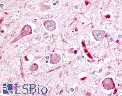 PathPlus™ WNT8A Antibody (Internal)
