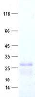 Human EMA / MUC1 Protein (Recombinant His, N-Terminal)