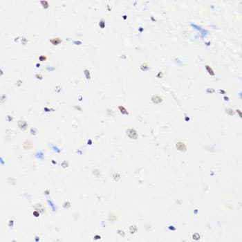 HIST2H4A Antibody