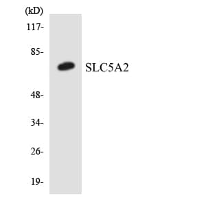 Polyclonal Rabbit anti-Human SLC5A2 / SGLT2 Antibody (aa92-141, WB)