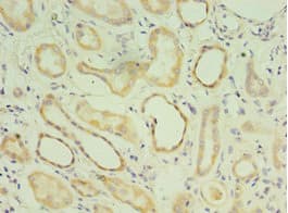 MATN3 / Matrilin 3 Antibody (aa277-486)