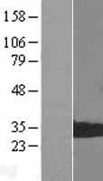 PSMB8 / LMP7 Protein (Over-Expression Lysate Myc-DDK (Flag))