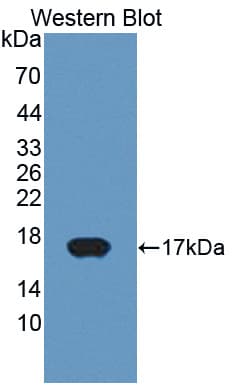 P450SCC / CYP11A1 Antibody (aa391-515)