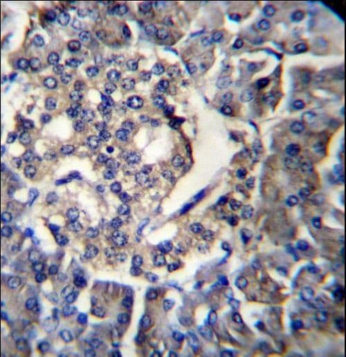 RPL35 / Ribosomal Protein L35 Antibody (aa86-115)