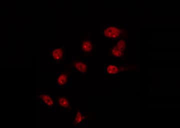 TBX10 Antibody