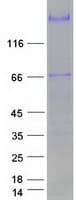Human PAPPA / PAPP-A Protein (Recombinant Myc-DDK (Flag))