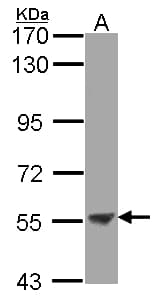 IHC-plus™ ENTPD3 Antibody (aa200-459)
