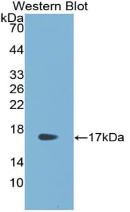 RSPO1 / RSPO Antibody (aa21-135)
