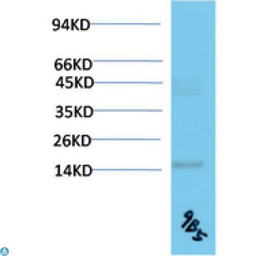 TTR / Transthyretin Antibody