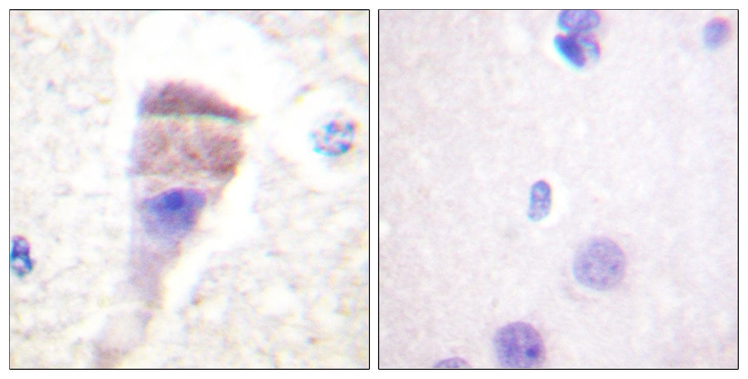 Polyclonal Rabbit anti-Human PRKD1 / PKC Mu Antibody (phospho-Ser205, IHC, WB)