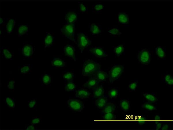 PRKAA1 / AMPK Alpha 1 Antibody (clone 4D8)